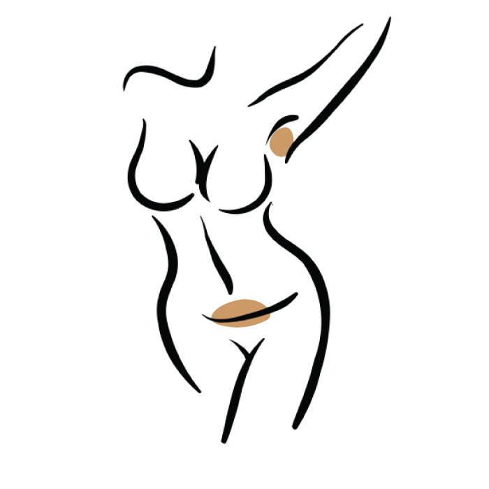 Laser Hair Removal Treatments