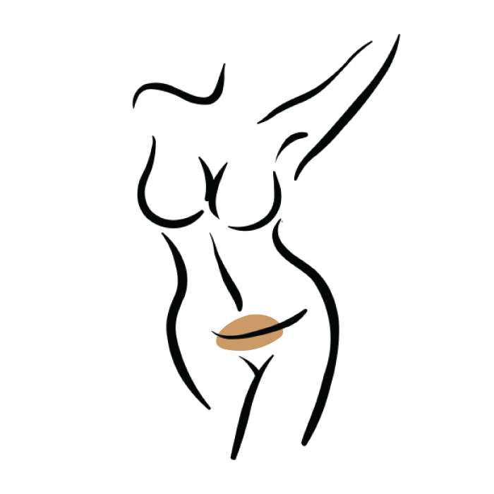 Laser Hair Removal Treatments